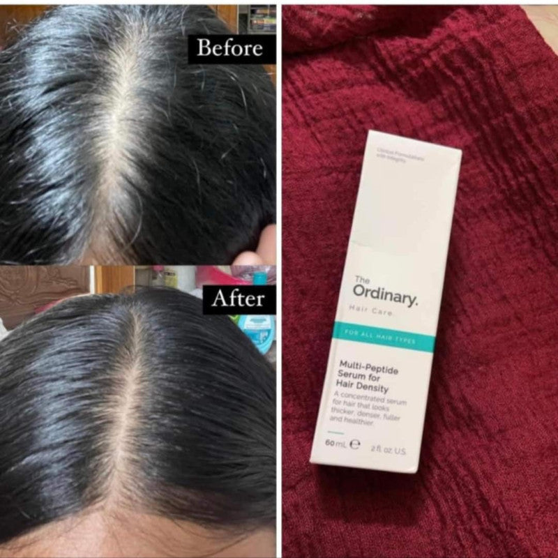 The Ordinary Multi-Peptide Hair Serum 60mL With Free Derma Roller đĨ