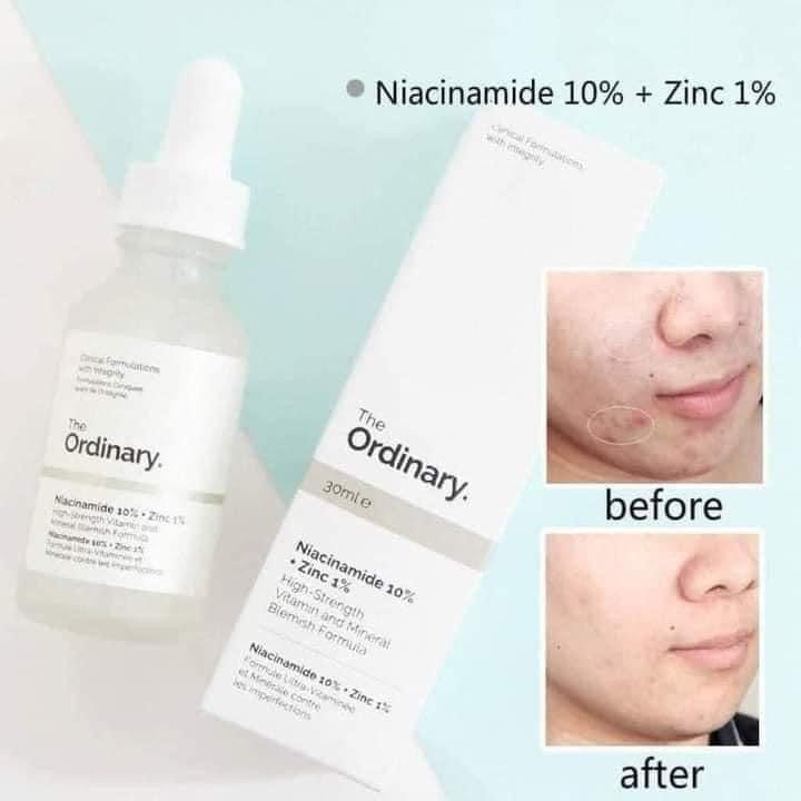 The Ordinary Niacinamide 10%+ Zinc 1% Serum 30mL