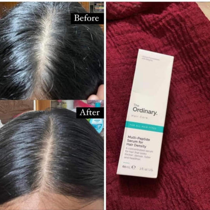 The Ordinary Multi-Peptide Hair Serum 60mL With Free Derma Roller 💥