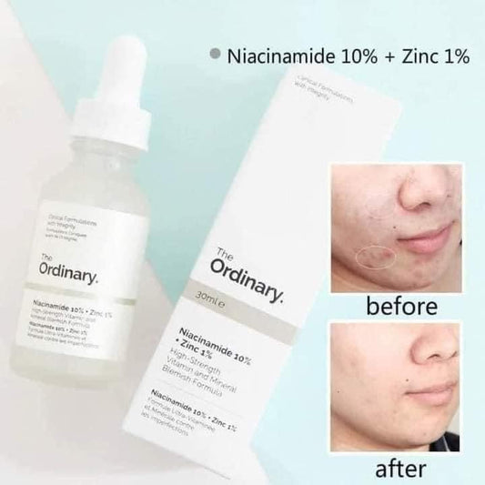 The Ordinary Niacinamide 10%+ Zinc 1% Serum 30mL