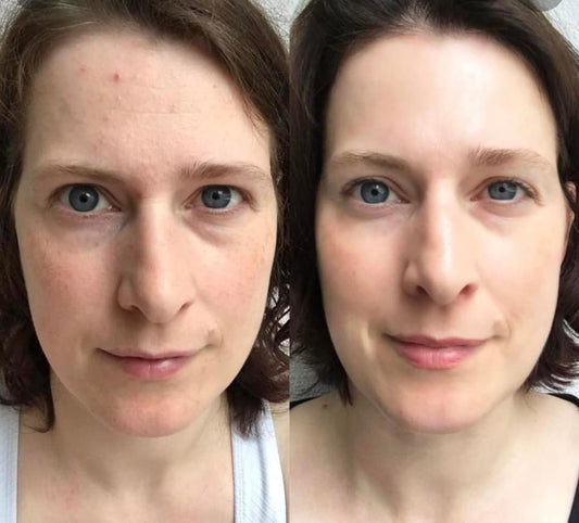 The Ordinary Retinol 1% in Squalane